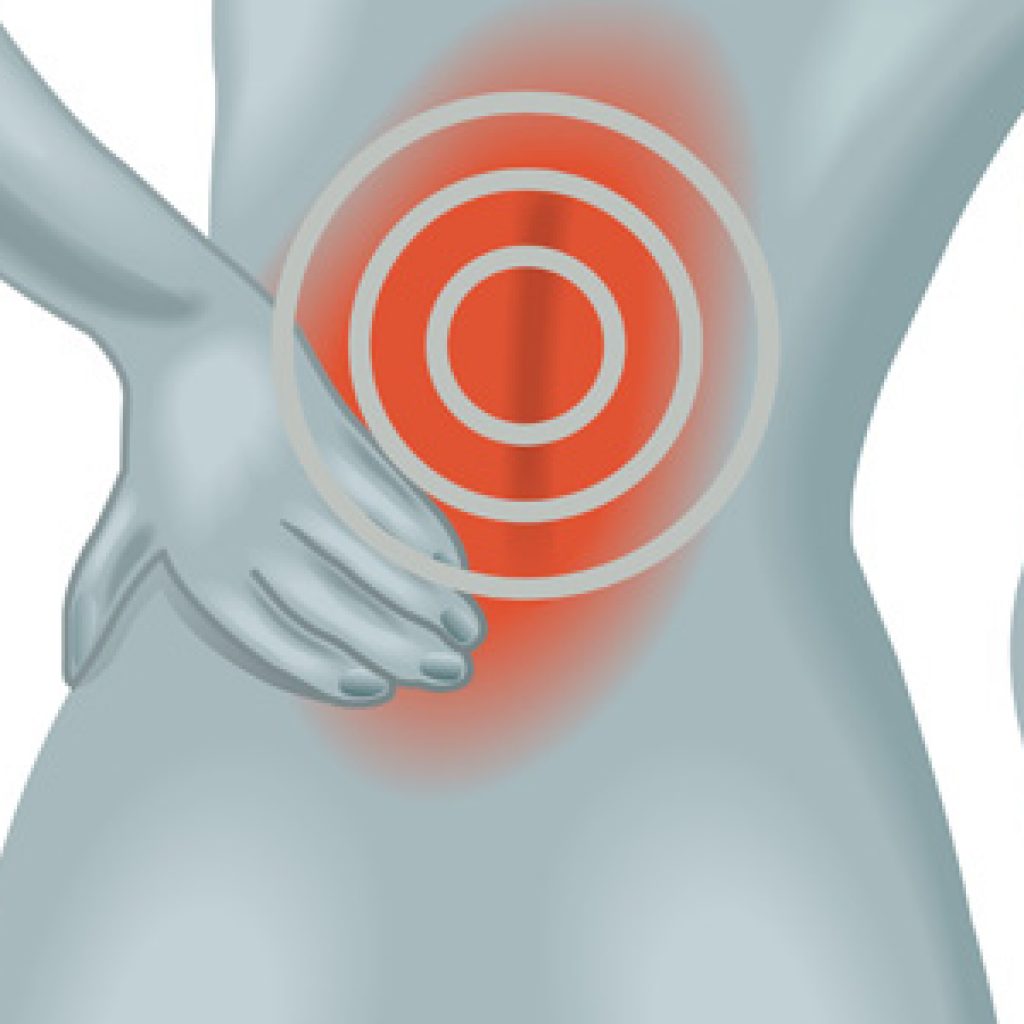 Trattamenti per cura lombalgia a Milano